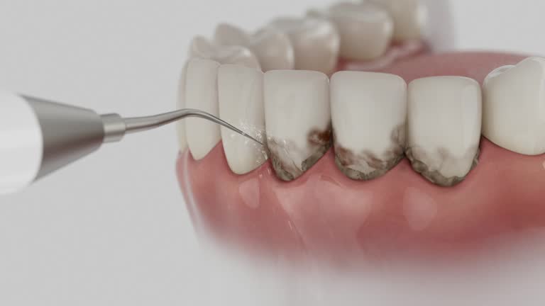 Trusted Teeth Cleaning And Checkup service in Clarkston, WA - Dentist Open Now